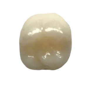 dental crown